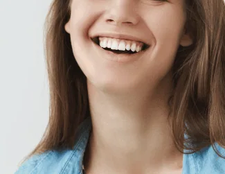 Acne after