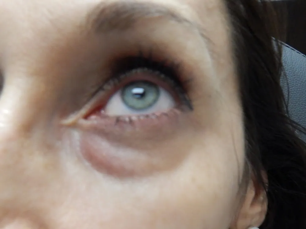 After Dark circle eyes