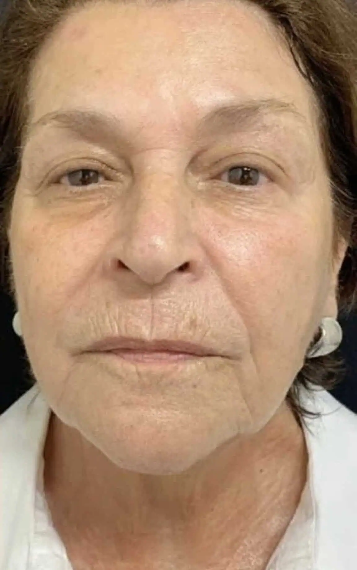 Skin After b