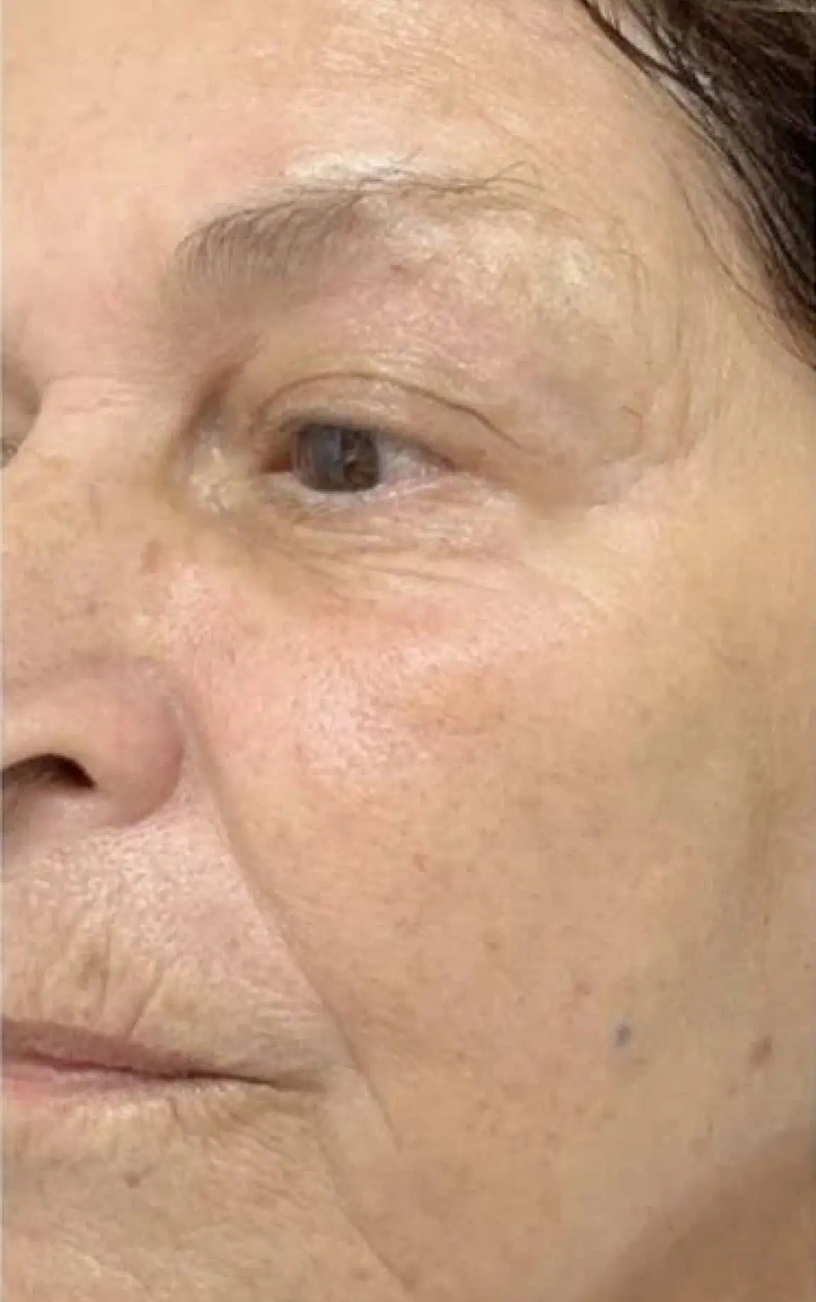Skin After c