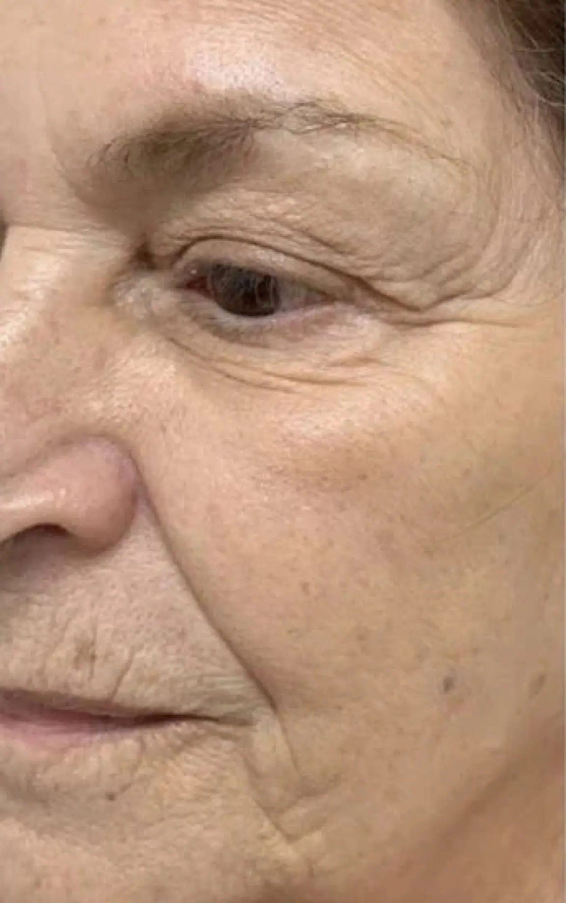 Skin before c
