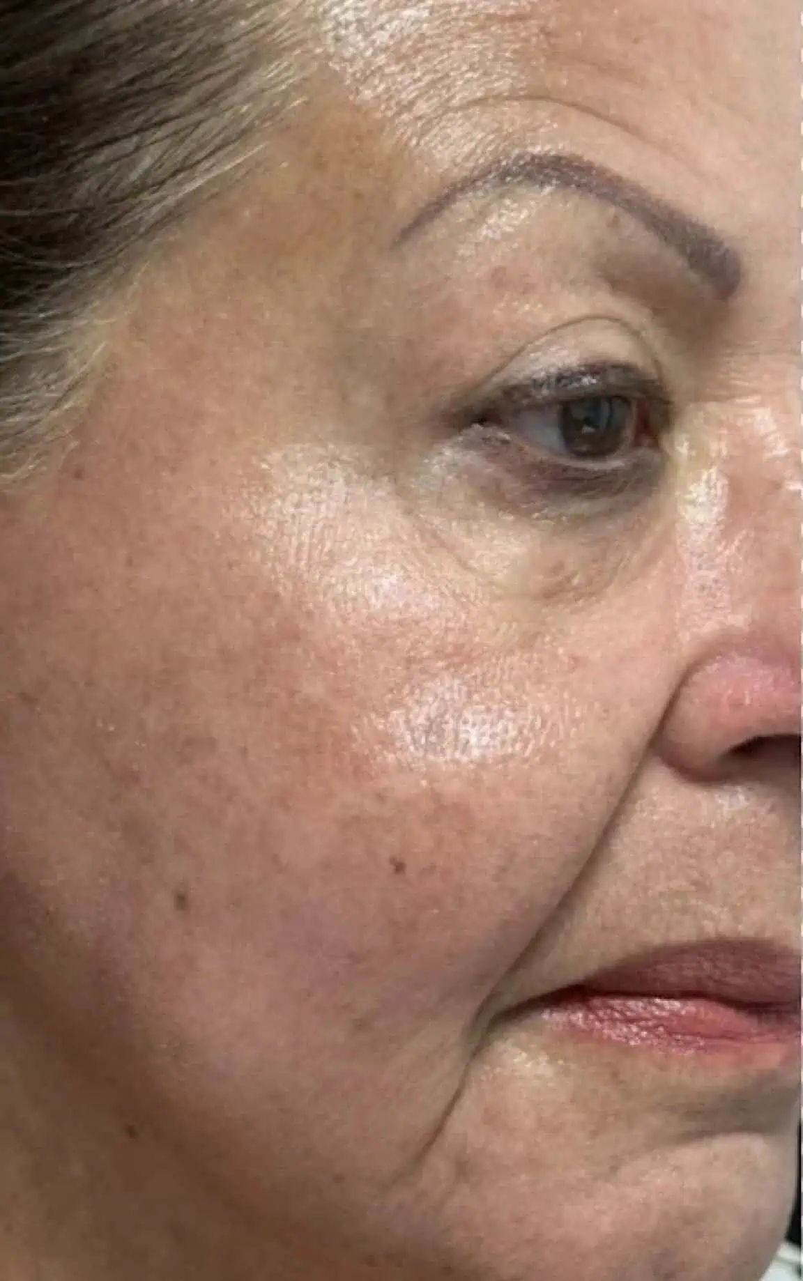 Skin before